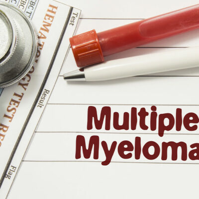 6 early signs of multiple myeloma