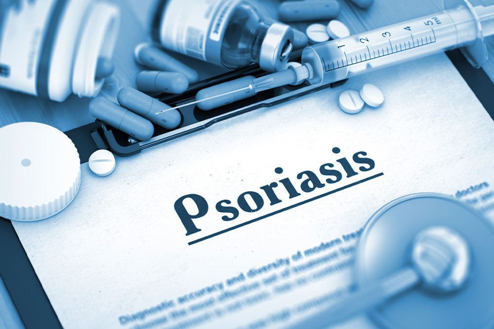 6 common health conditions linked to psoriasis